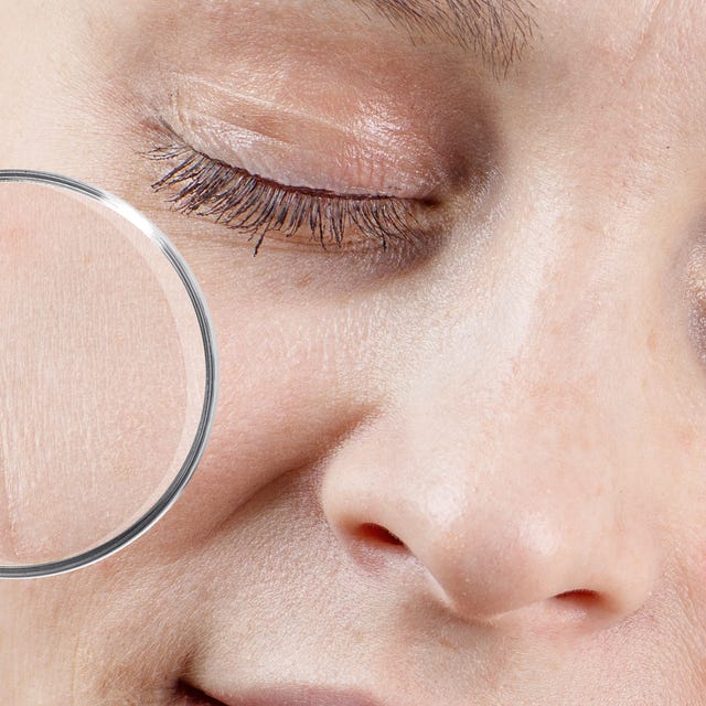 Derma_doffe_grauwe_huid.png Derma_doffe_grauwe_huid.png