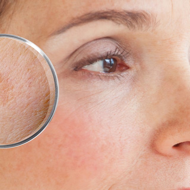 Derma_pigment_afbeelding.jpg Derma_pigment_afbeelding.jpg